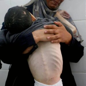 bir yanda katliam bir yanda aclik gazzede can kaybi 61 bin 430 oldu D1DL9cqU